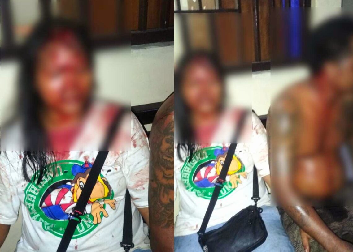 Alasan 3 Motor Pecalang Dibakar Pemuda Sumba dan Flores: Karena Ada Perempuan Yang Dipukul. Balitopik.com