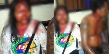 Alasan 3 Motor Pecalang Dibakar Pemuda Sumba dan Flores: Karena Ada Perempuan Yang Dipukul. Balitopik.com