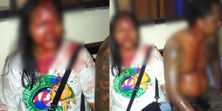 Alasan 3 Motor Pecalang Dibakar Pemuda Sumba dan Flores: Karena Ada Perempuan Yang Dipukul. Balitopik.com